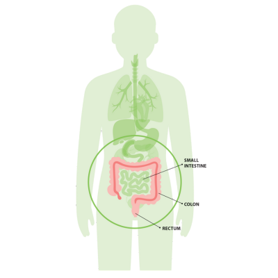 Green body with colon anatomy labelled. Rectum. Small intestine. Colon. (c) CancerCare Manitoba
