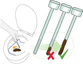 toilet with hand sampling stool inside toilet and three FIT sticks showing amount of stool to collect (c) CancerCare Manitoba