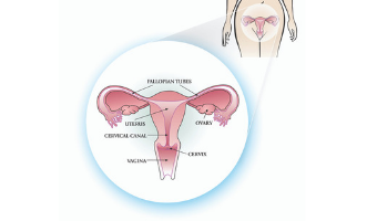 Reproductive system anatomy inside a client's body (c) CancerCare Manitoba