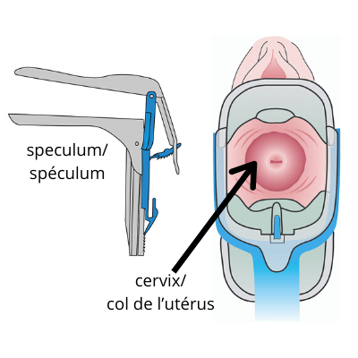 Speculum and view of cervix (c) CancerCare Manitoba