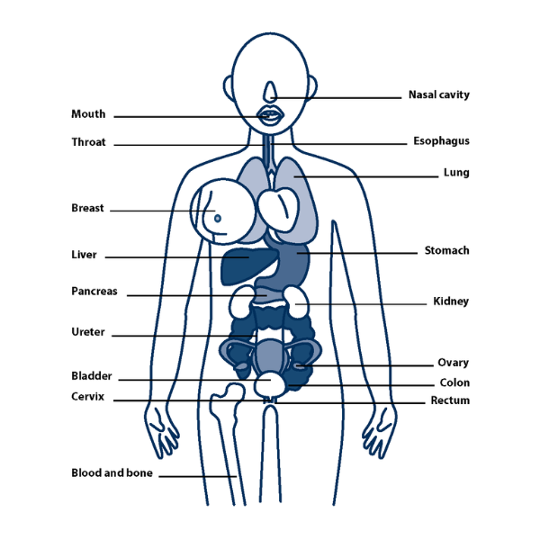 Cancers caused by smoking (c) CancerCare Manitoba