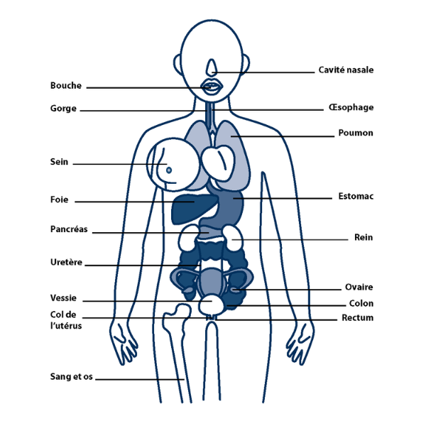 Les conséquences de la cigarette (c) CancerCare Manitoba